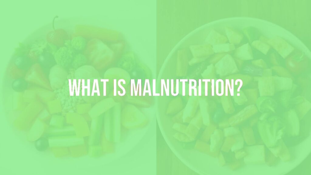 A balanced diet plate with fruits, vegetables, proteins, and grains, contrasted with an unhealthy plate of junk food, illustrating malnutrition, realistic style.